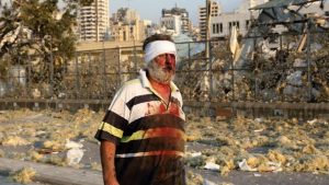 Penyebab Ledakan Besar di Beirut, Lebanon dan Tewaskan 78 Orang