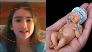 Amelia Taylor Bayi Terkecil di Dunia? Kini Tumbuh jadi Gadis Cantik
