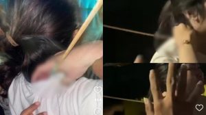 Viral Wanita Kena Busur di Leher saat Mau Makan Bakso