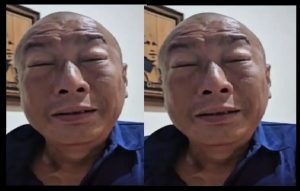 Viral Heru Gundul Matanya Disembur Ular Cobra, Begini Kondisinya!